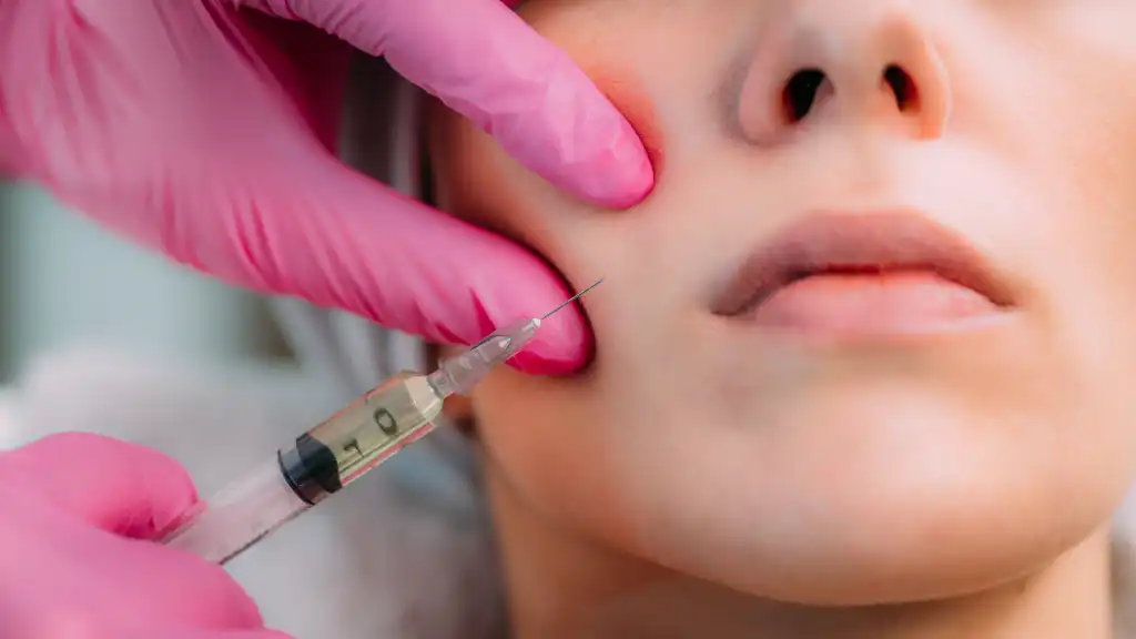 beauty land neuramis co dermal filler injection for cheeks 220525 220616