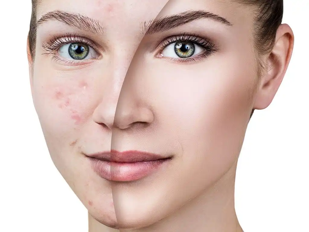 beauty land wagner shop skin blemishes 220612 220618