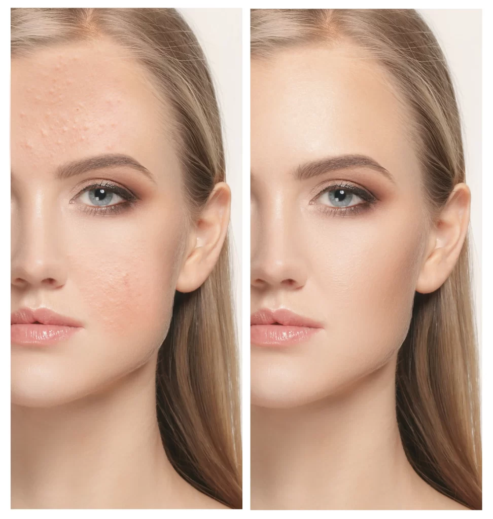 beauty land wagner shop woman before and after treatment wagner 220612 972x1024 220618