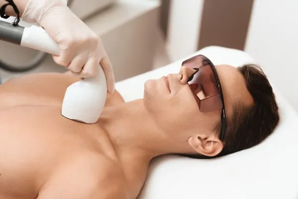 Laser hair removal