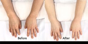 ژل کربوکسی ریب اسکین